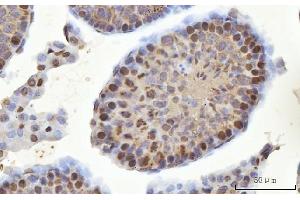 IHC analysis of MSY2/YBOX2/YBX2 using anti-MSY2/YBOX2/YBX2 antibody (ABIN7600636). (YBX2 anticorps  (AA 211-364))