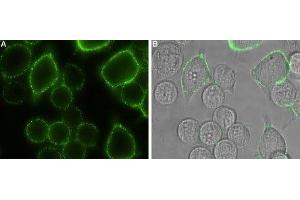 Expression of Orai1 in rat RBL cells - Cell surface detection of Orai1 in intact living rat basophilic leukemia (RBL) cells.