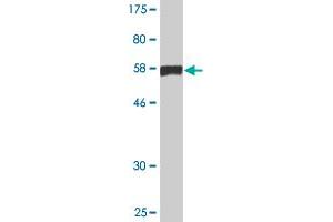 Western Blot detection against Immunogen (56. (C10orf81 anticorps  (AA 1-282))