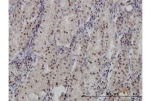 Immunoperoxidase of monoclonal antibody to FOXO3A on formalin-fixed paraffin-embedded human stomach.