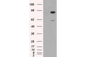 Western Blotting (WB) image for anti-Glucan (1,4-alpha-), Branching Enzyme 1 (GBE1) antibody (ABIN1498395)