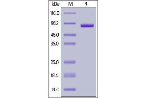 Biotinylated Human Siglec-15, Fc,Avitag on  under reducing (R) condition. (SIGLEC15 Protein (AA 20-263) (Fc Tag,AVI tag,Biotin))