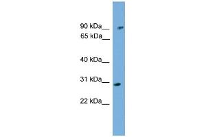 WB Suggested Anti-PHYH Antibody Titration: 0. (PHYH anticorps  (N-Term))