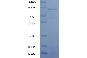 SDS-PAGE (SDS) image for S-Phase Kinase-Associated Protein 2 (SKP2) (AA 1-424), (full length) protein (His-SUMO Tag) (ABIN5711247)