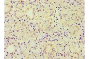 Immunohistochemistry of paraffin-embedded human pancreatic tissue using ABIN7143446 at dilution of 1:100 (ARF3 anticorps  (AA 1-181))