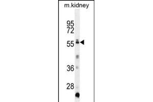 TRIML1 Antibody (C-term) (ABIN655761 and ABIN2845204) western blot analysis in mouse kidney tissue lysates (35 μg/lane). (TRIML1 anticorps  (C-Term))