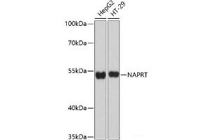 Western blot analysis of extracts of various cell lines using NAPRT Polyclonal Antibody at dilution of 1:3000. (NAPRT1 anticorps)