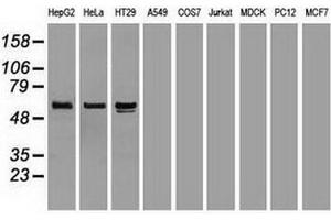 Western Blotting (WB) image for anti-alpha-Fetoprotein (AFP) (AA 19-397) antibody (ABIN2716009) (alpha Fetoprotein anticorps  (AA 19-397))
