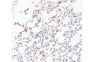 Immunohistochemistry analysis of paraffin-embedded mouse lung with LPS treated for 24h using CD206 (ABIN7074550) at dilution of 1: 800 (Mannose Receptor anticorps)