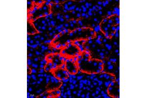 Immunofluorescence of paraffin embedded rat kidney using SLC7A8 (ABIN7074503) at dilution of 1:300 (400x lens)