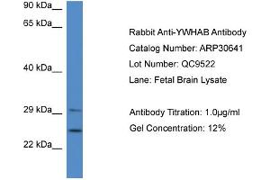 WB Suggested Anti-YWHAB Antibody   Titration: 1. (YWHAB anticorps  (Middle Region))