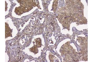 IHC analysis of Beta 2 Microglobulin using anti-Beta 2 Microglobulin antibody (ABIN6719452). (beta-2 Microglobulin anticorps  (AA 22-119))