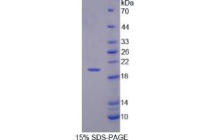 Image no. 1 for CD99 (CD99) (AA 31-185) protein (His tag) (ABIN4988707) (CD99 Protein (CD99) (AA 31-185) (His tag))
