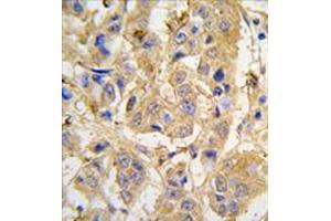 Image no. 1 for anti-Mitochondrial Intermediate Peptidase (MIPEP) (Center) antibody (ABIN356963) (MIPEP anticorps  (Center))