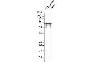 Western Blotting (WB) image for anti-Asense (C-Term) antibody (ABIN7272995) (Asense (C-Term) anticorps)
