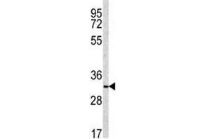 Western blot analysis of NQO1 antibody and NCI-H460 lysate (NQO1 anticorps  (AA 118-144))