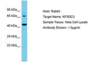Image no. 1 for anti-5'-Nucleotidase Domain Containing 3 (NT5DC3) (AA 30-79) antibody (ABIN6750613) (NT5DC3 anticorps  (AA 30-79))