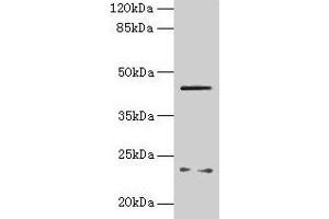 Western blot All lanes: FIBP antibody at 6 μg/mL + MCF-7 whole cell lysate Secondary Goat polyclonal to rabbit IgG at 1/10000 dilution Predicted band size: 42 kDa Observed band size: 42 kDa (FIBP anticorps  (AA 2-357))