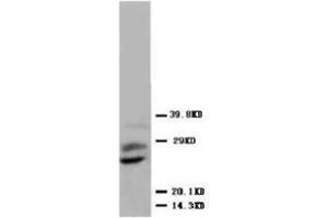 Western blot analysis of human placenta tissue lysis using PLGF antibody (PLGF anticorps  (N-Term))
