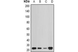 Western blot analysis of NCS1 expression in Hela (A), MCF7 (B), mouse bone marrow (C), rat kidney (D) whole cell lysates. (NCS1 anticorps)