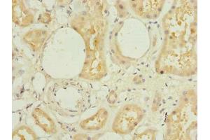 Immunohistochemistry of paraffin-embedded human kidney tissue using ABIN7172386 at dilution of 1:100