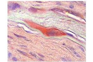 CSF1  CSF1 in human placenta was detected using HRP/AEC red color stain. (M-CSF/CSF1 anticorps  (Middle Region))