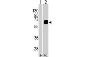 Western blot analysis of MYC (arrow) using MYC polyclonal antibody . (c-MYC anticorps  (Thr58))
