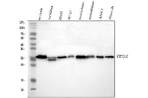 Western blot analysis of 14-3-3 zeta/delta using anti-14-3-3 zeta/delta antibody (ABIN5693157). (14-3-3 zeta anticorps)
