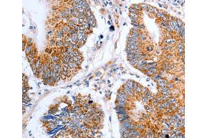 Immunohistochemistry (IHC) image for anti-Claudin 10 (CLDN10) antibody (ABIN2425959) (CLDN10 anticorps)