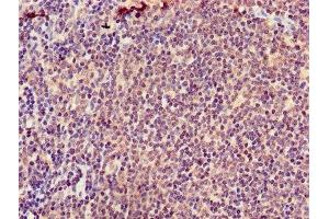 Immunohistochemistry of paraffin-embedded human lymph node tissue using ABIN7145576 at dilution of 1:100 (ATIC anticorps  (AA 301-592))