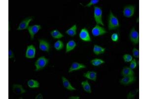 Immunofluorescence staining of A549 cells with ABIN7166074 at 1:133, counter-stained with DAPI. (S100A9 anticorps  (AA 2-114))