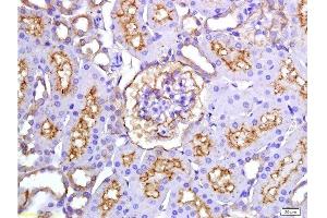 Formalin-fixed and paraffin embedded rat kidney tissue labeled with Anti-ET-1 Polyclonal Antibody, Unconjugated(bsm-0954M) 1:200 at followed by conjugation to the secondary antibody and DAB staining