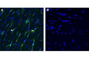 Expression of CD9 in rat fornix. (CD9 anticorps  (Extracellular))
