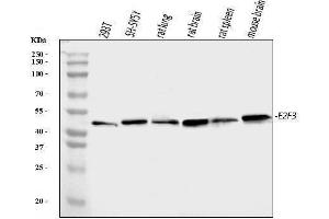 Western blot analysis of E2F3 using anti-E2F3 antibody (ABIN7602654).