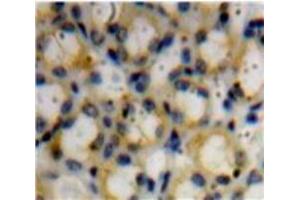 Used in DAB staining on fromalin fixed paraffin-embedded Kidney tissue (Decorin anticorps  (AA 45-152))