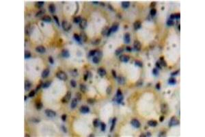 Used in DAB staining on fromalin fixed paraffin-embedded Kidney tissue