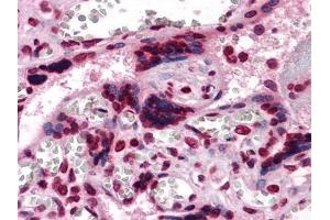 Immunohistochemical analysis of paraffin-embedded human Placenta tissues using anti-CSF1 mouse mAb