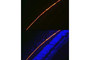 Immunofluorescence analysis of rat eye using RPE65 Rabbit mAb (ABIN7269933) at dilution of 1:100 (40x lens). (RPE65 anticorps)