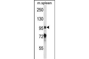 Western blot analysis in mouse spleen tissue lysates (35ug/lane). (PTK2B anticorps  (AA 672-701))