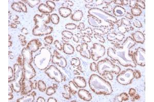 Formalin-fixed, paraffin-embedded human prostate stained with NKX3. (NKX3-1 anticorps  (AA 92-224))