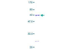 Image no. 1 for GTPase, IMAP Family Member 5 (GIMAP5) (AA 1-307) protein (GST tag) (ABIN1355097)