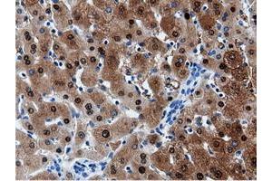 Image no. 4 for anti-Adenylate Kinase 5 (AK5) antibody (ABIN1496535) (Adenylate Kinase 5 anticorps)