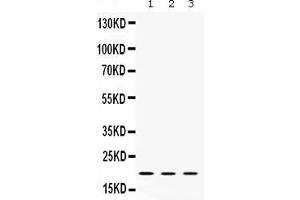 Western blot analysis of Cofilin 2 expression in rat liver extract ( Lane 1), mouse brain extract ( Lane 2) and HELA whole cell lysates ( Lane 3). (Cofilin 2 anticorps  (C-Term))