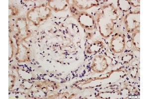 Formalin-fixed and paraffin embedded human kidney tissue labeled with Rabbit Anti-IRF9 Polyclonal Antibody, Unconjugated (ABIN2177064) at 1:200 followed by conjugation to the secondary antibody and DAB staining (IRF9 anticorps  (AA 101-200))