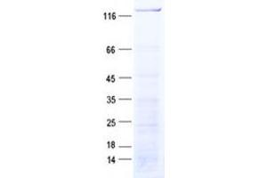 Validation with Western Blot