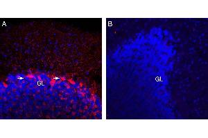 Expression of VGAT in rat cerebellum. (SLC32A1 anticorps  (Cytosolic, N-Term))