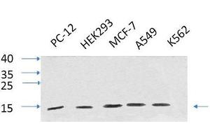 Western Blot analysis of various cells using IL8 Polyclonal Antibody at dilution of 1:1000. (IL-8 anticorps)
