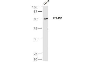 Hela lysates probed with PPM1D Polyclonal Antibody, Unconjugated  at 1:500 dilution and 4˚C overnight incubation. (PPM1D anticorps  (AA 201-300))