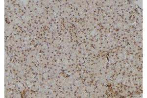 ABIN6264342 and ABIN6277090 at 1/100 staining Rat kidney tissue by IHC-P.