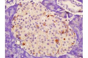 Formalin-fixed and paraffin embedded rat pancreas labeled with Rabbit Anti-CD62p Polyclonal Antibody, Unconjugated  at 1:200 followed by conjugation to the secondary antibody and DAB staining